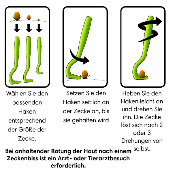 Zeckenzangen-Set (3 Größen) für Hunde, Katzen & Menschen – Einfache Zeckenentfernung